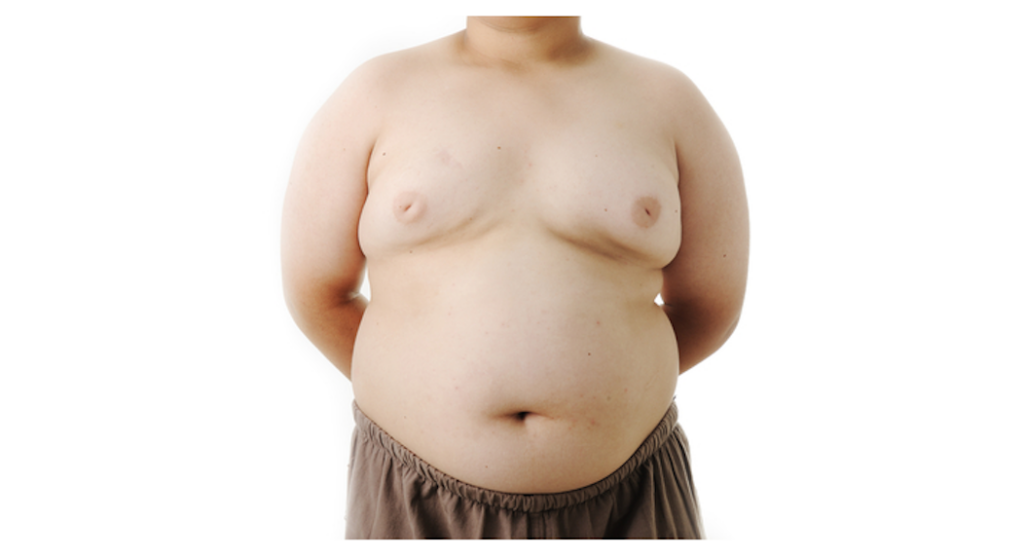 bambini obesi